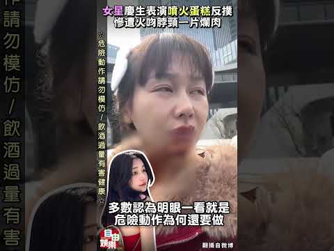 女星慶生表演「噴火蛋糕」特效反撲 慘遭火吻脖頸一片爛肉 サムネイル